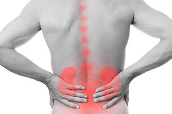 Бъбречните патологии могат да провокират появата на болка в долната част на гърба